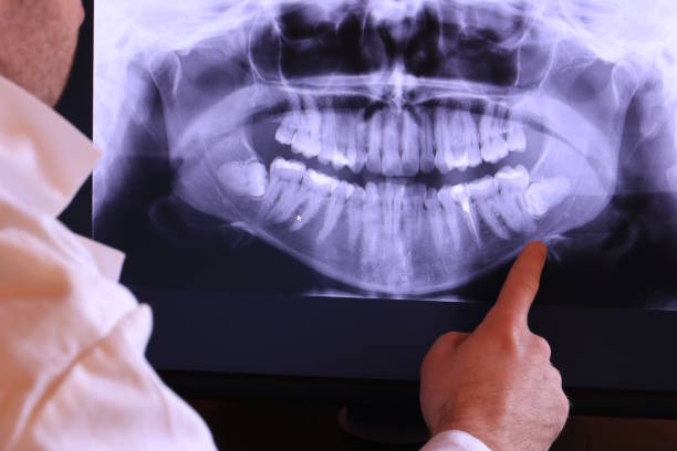 Best Emergency Dental Care for Broken or Chipped Teeth in Los Ranchos, CA